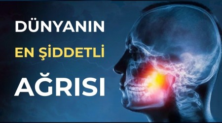 D�nyan�n En �iddetli A�r�s�