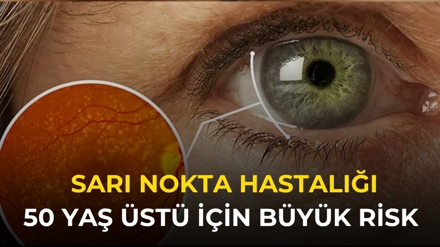 50 Ya� �st� ��in B�y�k Risk: Sar� Nokta Hastal���