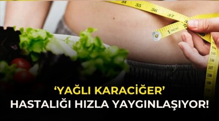 �Ya�l� karaci�er� hastal��� h�zla yayg�nla��yor!