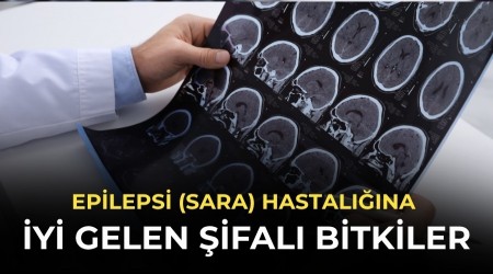 Epilepsi (Sara) Hastal���na iyi gelen �ifal� bitkiler